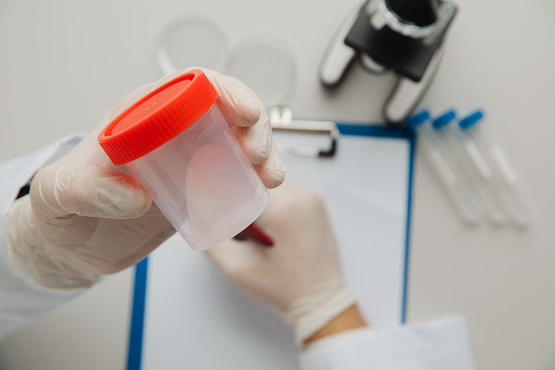 Infertility Diagnosis Tests details